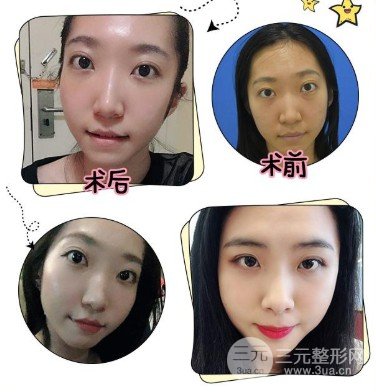 嫩肤美白的医美方法