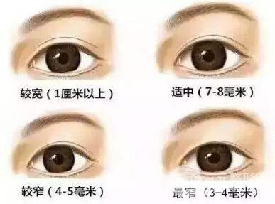 割双眼皮后一宽一窄是为什么?