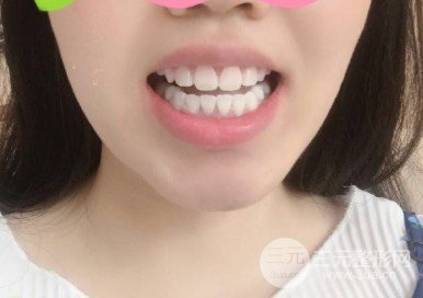 泸州佳利口腔医院收费标准