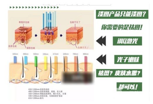 激光祛斑一次多少钱