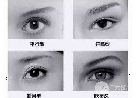 欧式双眼皮适合人群