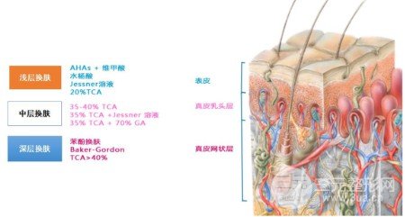 果酸焕肤前后果对比图