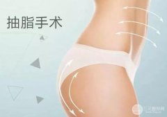 抽脂图片过程图片反馈，抽脂果真实果参考！