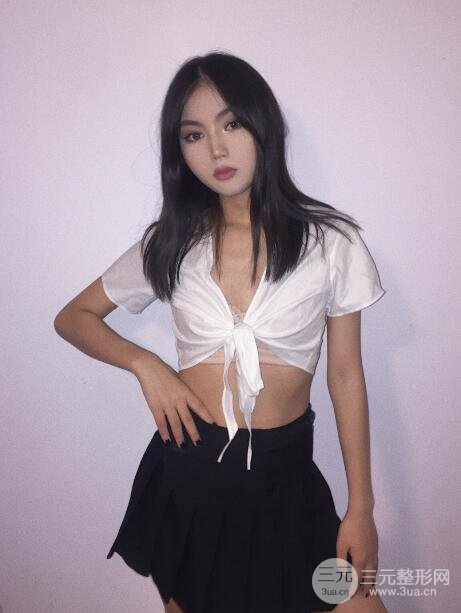 抽脂手术案例