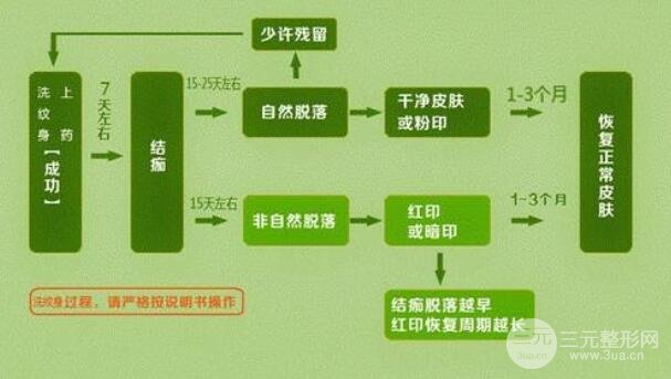 洗纹身事项问与答：