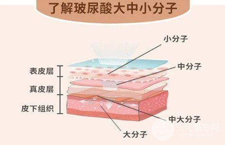 注射玻尿酸费用多少