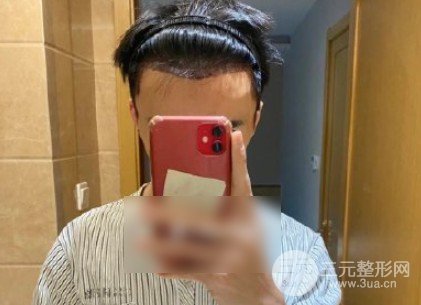 男生发际线中间有个尖发型