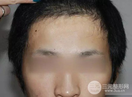 男生发际线中间有个尖发型