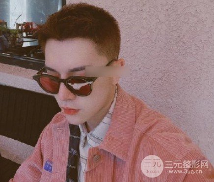 男生发际线中间有个尖发型