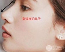 鼻子做完假体9天恢复图高清,见证颜值的蜕变! 鼻子做完假体9天恢复图高清,见证颜值的蜕变!