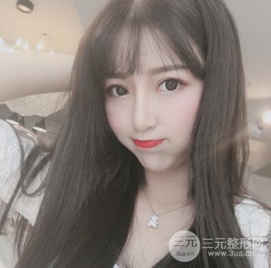 割双眼皮真人案例