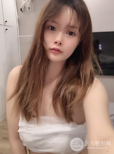 隆胸案例