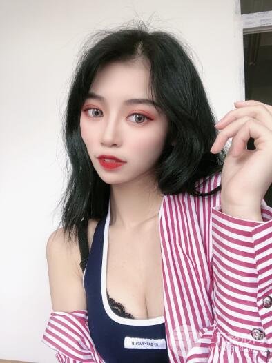 丰胸手术案例
