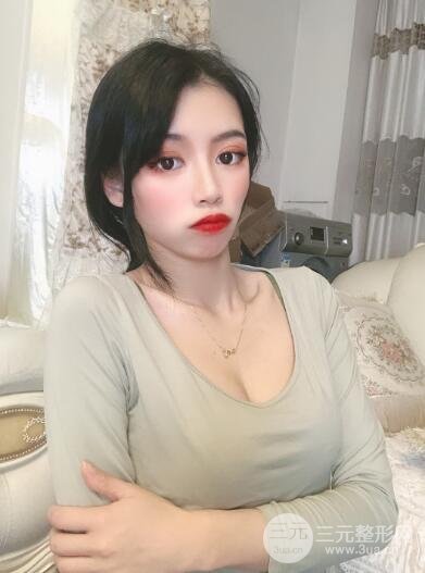 丰胸手术案例