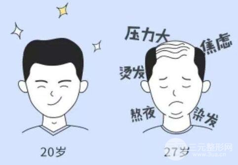 男士植发果图高清发布,基本摆脱秃头方法get