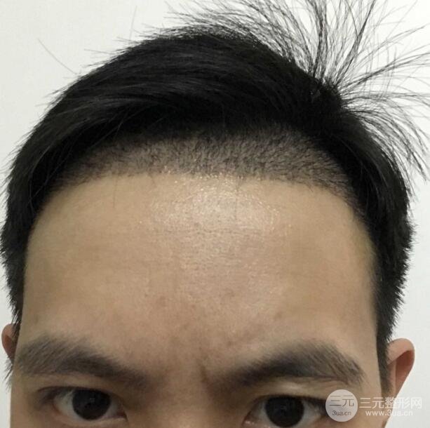 缓解期间