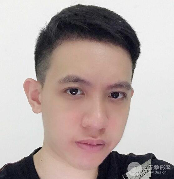 恢复期间