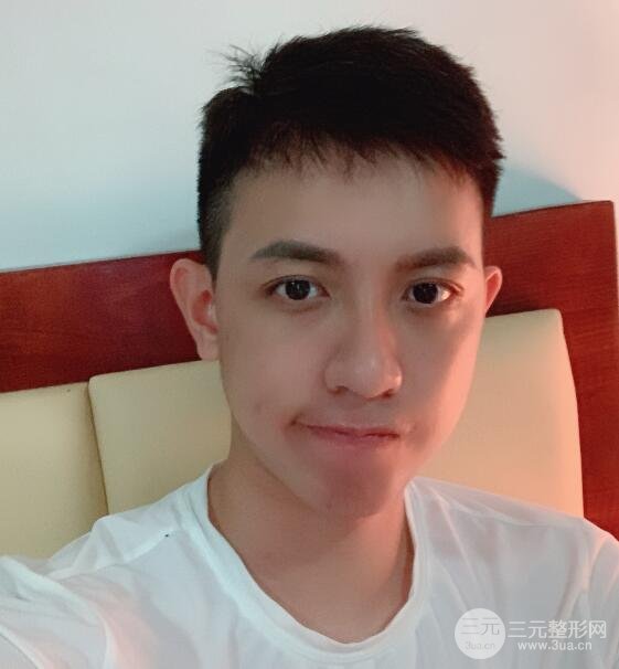 恢复期间
