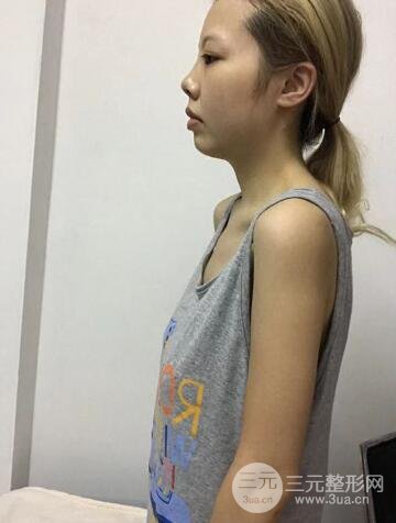 缓解期间