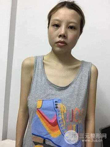 缓解期间