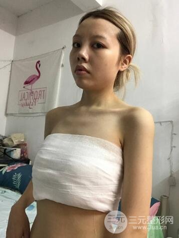恢复期间