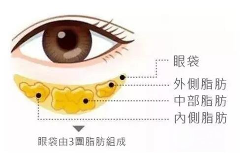 用什么可以去眼袋