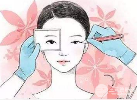 割双眼皮多久恢复