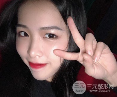 激光美容祛痘前后果对比