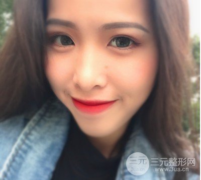 激光美容祛痘前后果对比