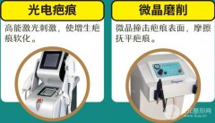 激光去疤痕的图片 果+原理讲解，疤友必看！