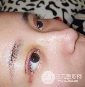 手术后常见的正常问题