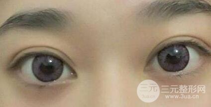 手术后常见的正常问题