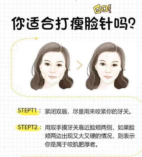 注射瘦脸的优势