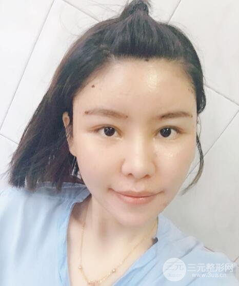 缓解期间