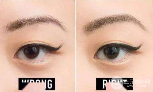 种植眉毛前后图片