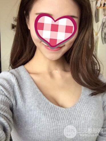 假体隆胸果对比图分享贫乳到爆乳的变化太惊艳