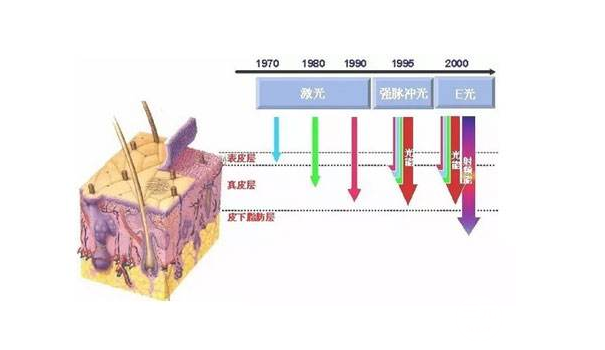 激光去红血丝价格