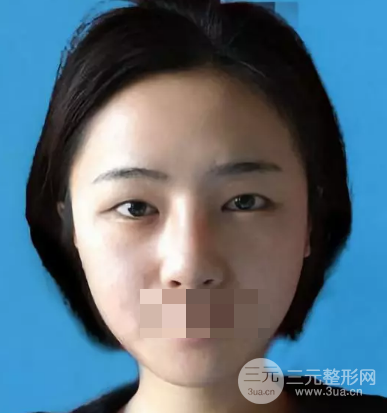 韩式翘睫双眼皮