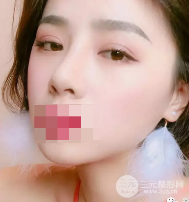 韩式翘睫双眼皮