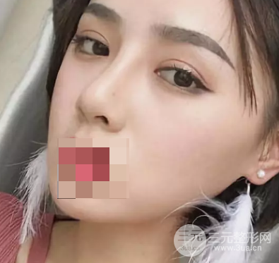 韩式翘睫双眼皮