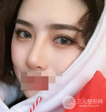 韩式翘睫双眼皮