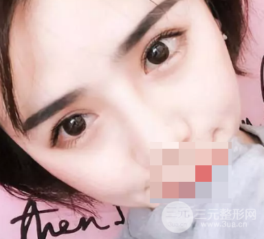 韩式翘睫双眼皮