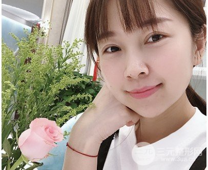 真实玻尿酸隆下巴日记