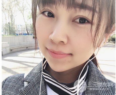 真实玻尿酸隆下巴日记