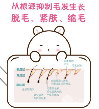 冰点脱毛要几次才能完全去掉