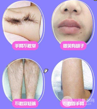 冰点脱毛要几次才能完全去掉
