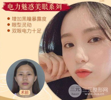 开眼角手术痛吗