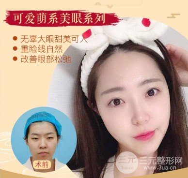 开眼角手术痛吗