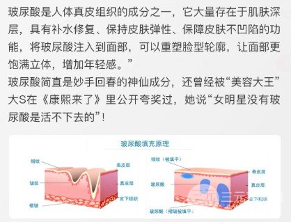 玻尿酸维持时间多长