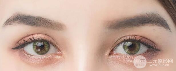 开眼角手术恢复时间